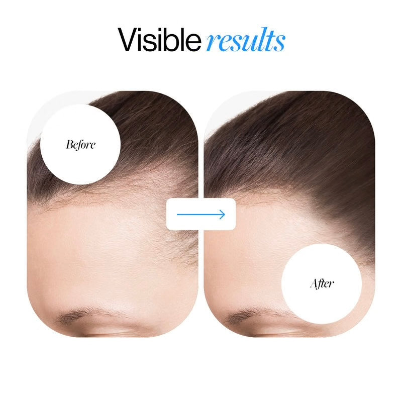 Hair Loyen Roll-On Serum