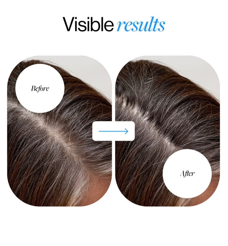 Hair Loyen Roll-On Serum