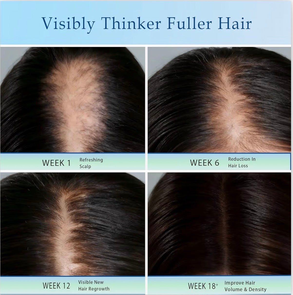 Hair Loyen Roll-On Serum